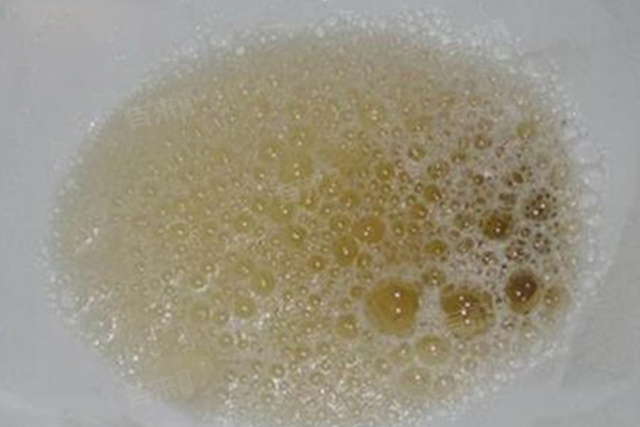 Thận su&yacute;t &ldquo;hỏng ho&agrave;n to&agrave;n&rdquo;, người đ&agrave;n &ocirc;ng 42 tuổi thầm cảm ơn bản th&acirc;n v&igrave; ch&uacute; &yacute; 1 dấu hiệu nhiều người bỏ qua- Ảnh 2.