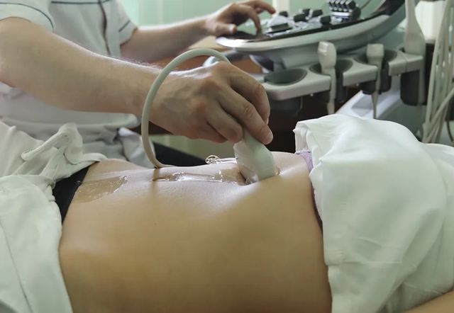 Người phụ nữ 60 tuổi mắc ung thư gan, một nửa gan là mỡ vì ngày nào cũng ăn 2 món "vạn người mê"- Ảnh 2. Người phụ nữ 60 tuổi mắc ung thư gan, một nửa gan là mỡ vì ngày nào cũng ăn 2 món "vạn người mê"- Ảnh 2.