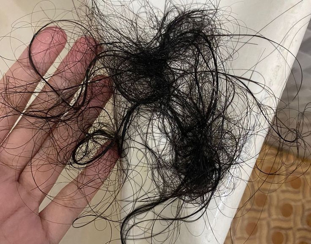 Bất kể nam hay nữ, ăn c&agrave;ng nhiều 5 m&oacute;n n&agrave;y t&oacute;c c&agrave;ng rụng "lả tả", h&oacute;i l&uacute;c n&agrave;o chẳng hay!- Ảnh 1.