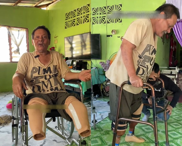 Đừng uống nước ngọt theo c&aacute;ch n&agrave;y: Người đ&agrave;n &ocirc;ng phải cắt bỏ cả hai ch&acirc;n, nhiều tiền cũng trở n&ecirc;n v&ocirc; nghĩa- Ảnh 1.