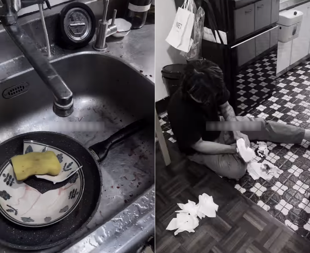 Rửa bát, tay người đàn ông chảy máu xối xả, phải khâu 4 mũi: Bác sĩ cảnh báo thói quen nhiều người mắc- Ảnh 1. Rửa bát, tay người đàn ông chảy máu xối xả, phải khâu 4 mũi: Bác sĩ cảnh báo thói quen nhiều người mắc- Ảnh 1.