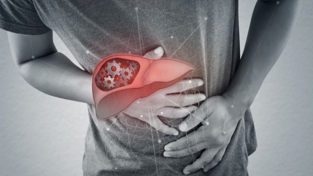 Bụng ngày càng to, nước tiểu sẫm màu: Cẩn trọng với 7 dấu hiệu cảnh báo xơ gan- Ảnh 1.
