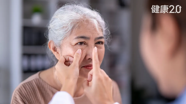 Gan nhiễm mỡ c&oacute; thể nhận biết qua khu&ocirc;n mặt: 3 dấu hiệu tr&ecirc;n cơ thể cảnh b&aacute;o bệnh, bao gồm cả đường chỉ tay v&agrave; lưỡi - Ảnh 1.