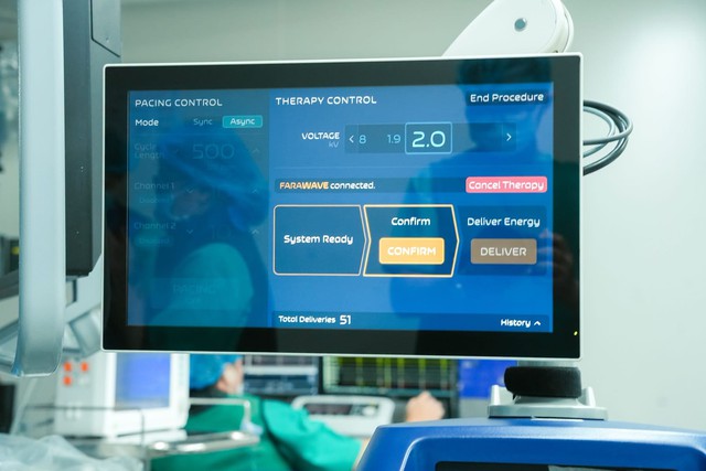 Bệnh viện Thống Nhất ti&ecirc;n phong triển khai thường quy kỹ thuật PFA điều trị rung nhĩ - Ảnh 2.