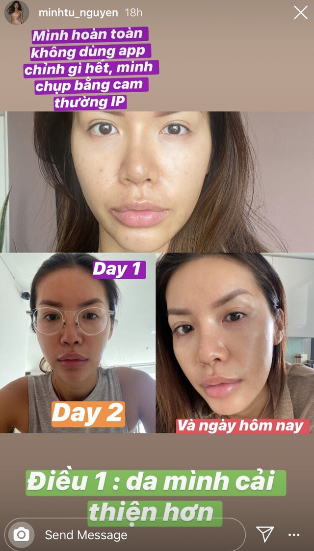 Minh T&uacute; tuổi 34 phục hồi da th&agrave;nh c&ocirc;ng, mặt căng b&oacute;ng rạng rỡ nhờ loại nước c&oacute; nguy&ecirc;n liệu b&aacute;n đầy ngo&agrave;i chợ- Ảnh 4.