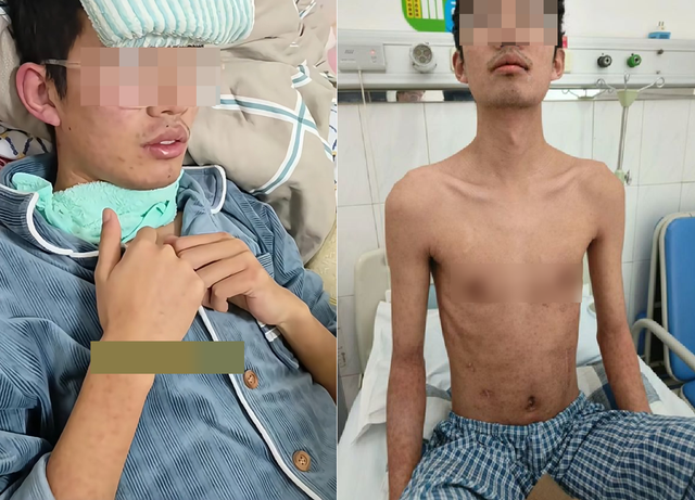 25 tuổi ph&aacute;t hiện ung thư gan giai đoạn cuối, b&aacute;c sĩ x&oacute;t xa: 3 sai lầm đang &acirc;m thầm &ldquo;hủy hoại&rdquo; l&aacute; gan nhiều người mắc phải- Ảnh 1.