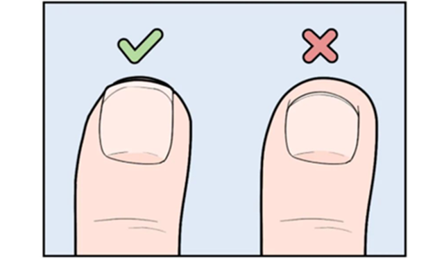 N&ecirc;n cắt m&oacute;ng tay h&igrave;nh tr&ograve;n hay h&igrave;nh vu&ocirc;ng? Nhiều người thường mắc sai lầm ở 3 chi tiết n&agrave;y- Ảnh 2.