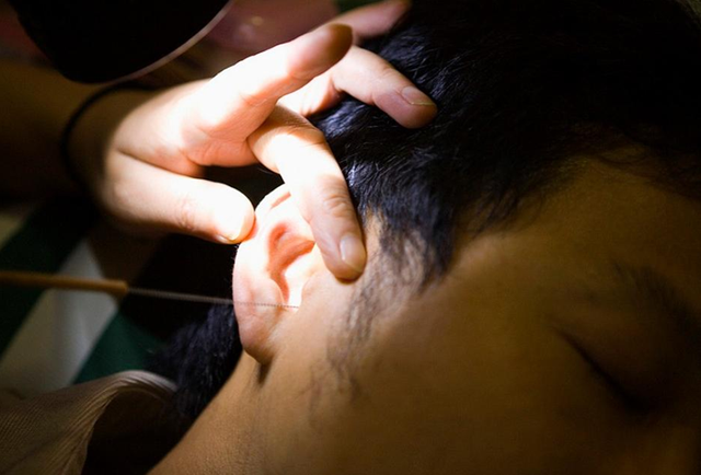 Người đ&agrave;n &ocirc;ng 30 tuổi tai chảy dịch c&oacute; m&ugrave;i lạ v&igrave; th&oacute;i quen nhiều người l&agrave;m v&agrave;i giờ mỗi ng&agrave;y- Ảnh 2.