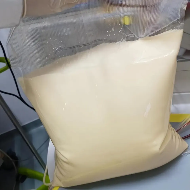 25 tuổi, m&aacute;u chuyển trắng như sữa, c&ugrave;ng l&uacute;c mắc 3 bệnh nguy kịch: B&aacute;c sĩ cảnh b&aacute;o lối sống n&agrave;y đang &acirc;m thầm &ldquo;b&ocirc;i mỡ&rdquo; v&agrave;o m&aacute;u người trẻ - Ảnh 1.