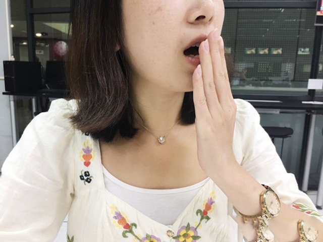 Ng&agrave;y c&agrave;ng nhiều người c&ograve;n trẻ đ&atilde; chết v&igrave; ung thư gan? B&aacute;c sĩ nhắc: Đừng bỏ lỡ "2 h&ocirc;i, 2 ngứa, 2 đỏ" đang b&aacute;o bệnh - Ảnh 3.