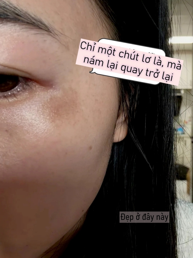 T&ocirc;i lười chống nắng v&agrave;i ng&agrave;y v&agrave; n&aacute;m quay lại r&otilde; rệt: Đ&acirc;y l&agrave; sai lầm nhiều người mắc phải!- Ảnh 1.