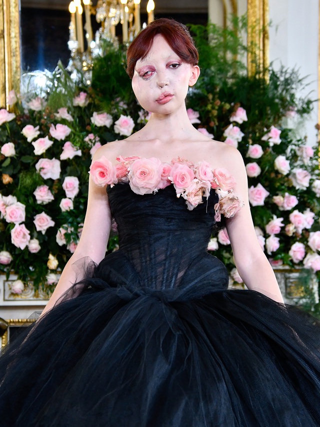 "Thi&ecirc;n nga trắng" hot nhất Oscar 2026: Một gương mặt biến dạng lại thu h&uacute;t hơn 13 triệu lượt xem- Ảnh 4.