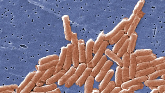 58 người sốt cao, ti&ecirc;u chảy nhập viện cấp cứu, thủ phạm đến từ 1 thứ trong bếp mọi gia đ&igrave;nh, rửa đi rửa lại vẫn đầy vi khuẩn  - Ảnh 2.