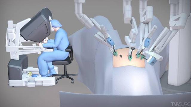 Mổ bằng robot c&oacute; thực sự tốt hơn kh&ocirc;ng? - Ảnh 2.