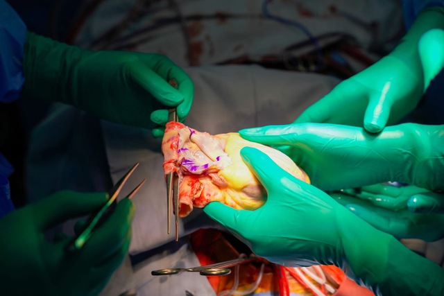 H&agrave;nh tr&igrave;nh &ldquo;Tr&aacute;i tim Quảng Ninh&rdquo; v&agrave; ph&eacute;p m&agrave;u xuy&ecirc;n Việt: Cứu sống ch&agrave;ng trai 23 tuổi phụ thuộc ECMO - Ảnh 3.