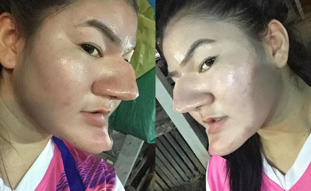 B&aacute;c sĩ thẩm mỹ: "V&igrave; sao c&agrave;ng sửa c&agrave;ng xấu?" - Ảnh 1.