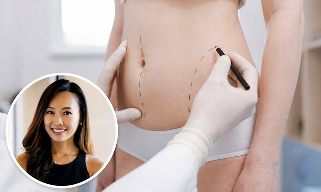 H&uacute;t mỡ ra ngo&agrave;i rồi đem cấp đ&ocirc;ng bảo quản, đợi chờ l&agrave;m đẹp trong tương lai: Cảnh b&aacute;o tr&agrave;o lưu tiềm ẩn rủi ro- Ảnh 2.