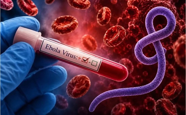 Sát thủ vô hình Ebola: Nhận diện đúng để không hoảng loạn - Ảnh 3.