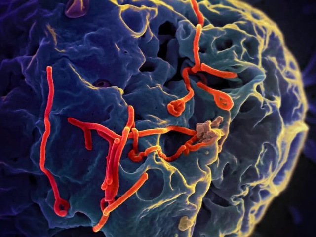 Sát thủ vô hình Ebola: Nhận diện đúng để không hoảng loạn - Ảnh 4.