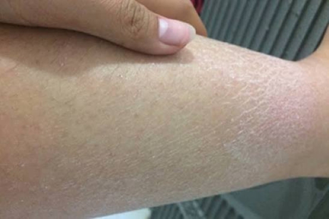 Các bác sĩ nói thẳng: Bắp chân là "đèn báo" đột quỵ, thấy 5 thứ phải đến bệnh viện ngay!- Ảnh 4. Các bác sĩ nói thẳng: Bắp chân là "đèn báo" đột quỵ, thấy 5 thứ phải đến bệnh viện ngay!- Ảnh 4.