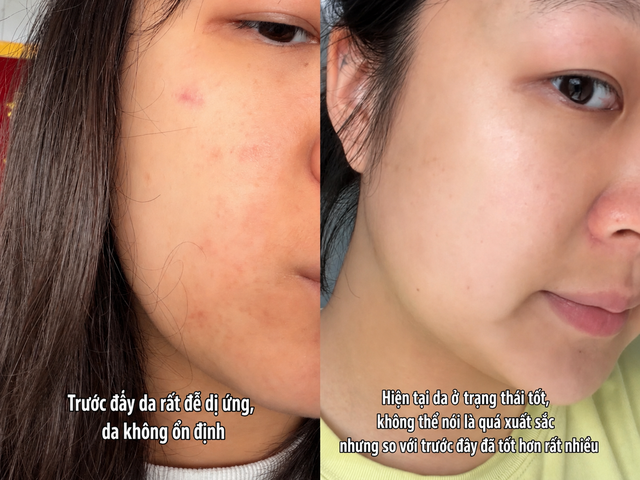 Không giúp đẹp sau một đêm, nhưng thói quen này khiến làn da của tôi ổn định hơn từng ngày - Ảnh 2.