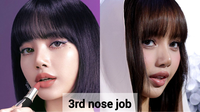 Nhận không ra mỹ nhân đẹp nhất thế giới: Nhan sắc thay đổi chóng mặt, vì 1 chiếc mũi mà nổi tiếng toàn cầu- Ảnh 5. Nhận không ra mỹ nhân đẹp nhất thế giới: Nhan sắc thay đổi chóng mặt, vì 1 chiếc mũi mà nổi tiếng toàn cầu- Ảnh 5.