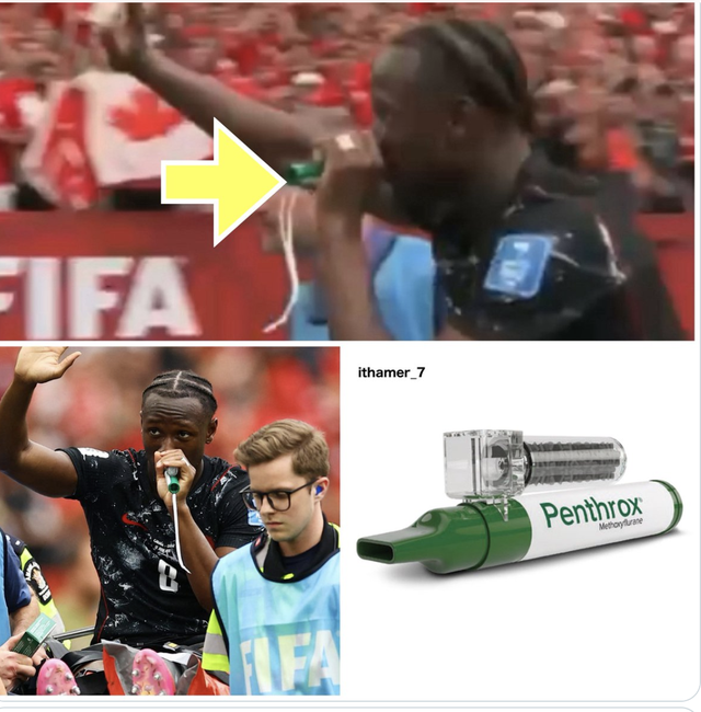 Ngôi sao Canada gãy chân rùng rợn ở World Cup hít cái gì màu xanh?- Ảnh 1. Ngôi sao Canada gãy chân rùng rợn ở World Cup hít cái gì màu xanh?- Ảnh 1.