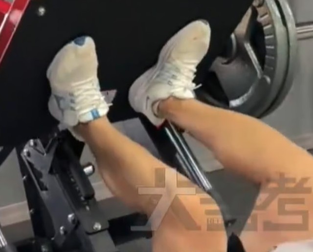 Nam thanh niên 23 tuổi suy thận cấp sau khi tập gym, chỉ số tổn thương cơ tăng gấp 100 lần - Ảnh 1.