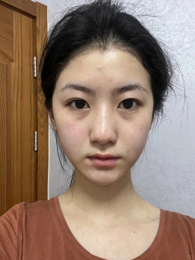 5 th&oacute;i quen khiến collagen "r&uacute;t cạn" mỗi ng&agrave;y nhanh hơn bạn tưởng- Ảnh 2.