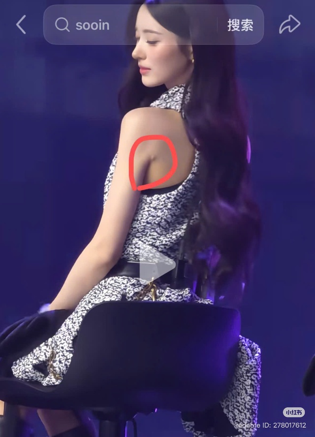 Đệ nhất mỹ nh&acirc;n showbiz thế hệ mới đẹp như tượng tạc vẫn kh&ocirc;ng h&agrave;i l&ograve;ng kh&aacute;n giả, lộ dấu vết h&uacute;t mỡ g&acirc;y sốc - Ảnh 4.