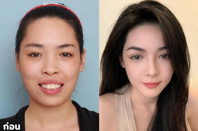 C&ocirc; g&aacute;i Việt sống đến 23 tuổi mới được trời trao gương mặt mỹ nh&acirc;n, hơn 10 năm chưa l&atilde;ng ph&iacute; visual ng&agrave;y n&agrave;o- Ảnh 1.