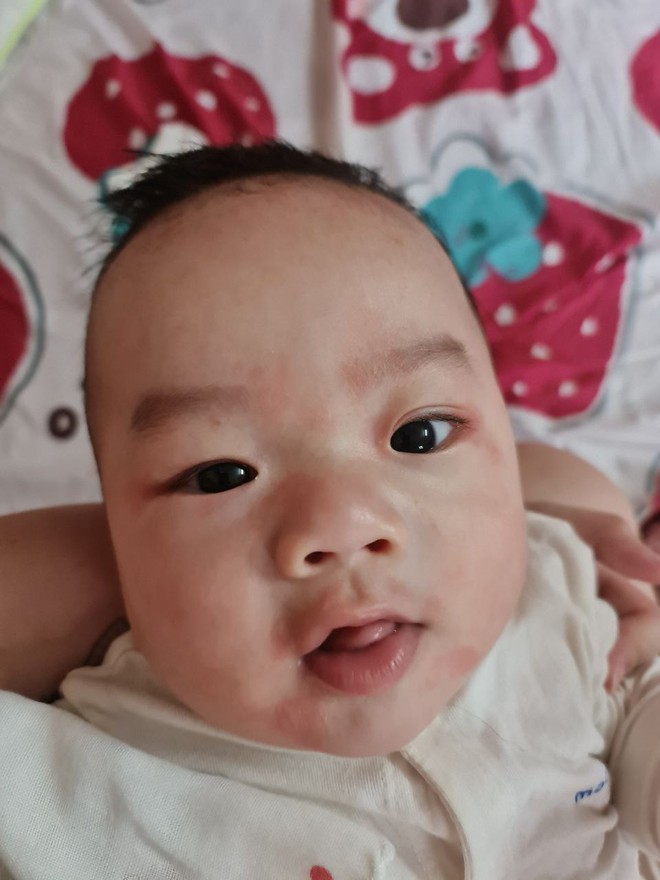 Vật lộn chọn sữa cho con bị dị ứng đạm sữa bò trong điều kiện kinh tế không quá xuất sắc, mẹ bỉm chia sẻ kinh nghiệm để có được 1 em bé 19 tháng nặng 17kg- Ảnh 3.