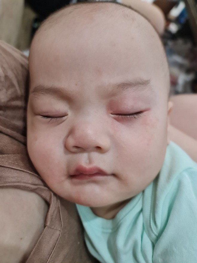 Vật lộn chọn sữa cho con bị dị ứng đạm sữa bò trong điều kiện kinh tế không quá xuất sắc, mẹ bỉm chia sẻ kinh nghiệm để có được 1 em bé 19 tháng nặng 17kg- Ảnh 5.