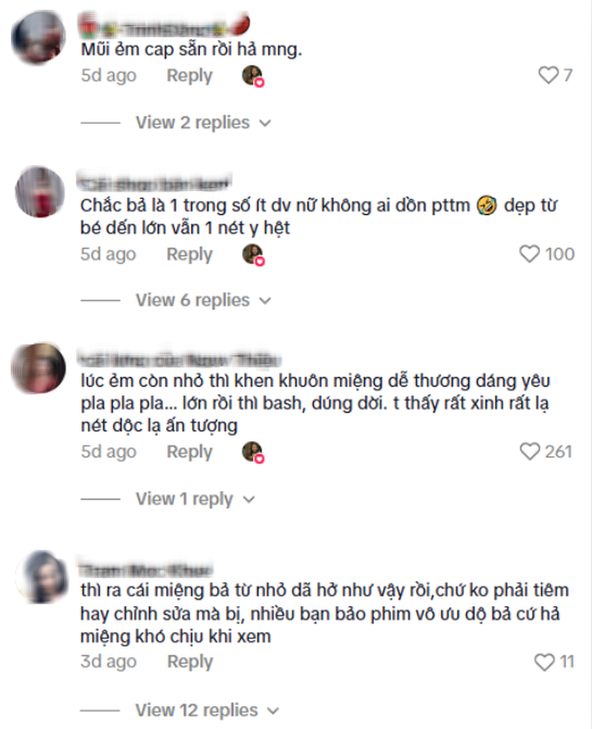 Đôi môi trái tim đẹp quá mức của nữ chính Khom Lưng gây tranh cãi, fan phải vội minh oan- Ảnh 11. Đôi môi trái tim đẹp quá mức của nữ chính Khom Lưng gây tranh cãi, fan phải vội minh oan- Ảnh 11.