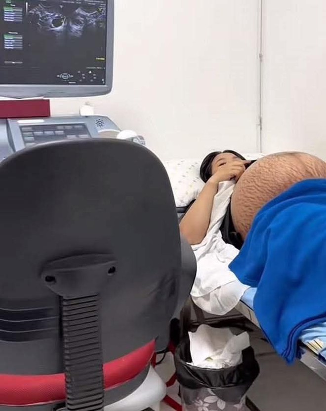 Xót xa hình ảnh chiếc bụng rạn nứt chằng chịt như dưa bở của mẹ bầu thai đôi ở tuần thứ 36- Ảnh 4.
