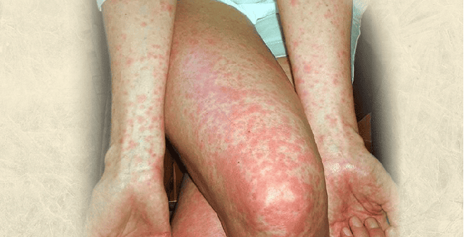 Sau sinh em bé, cứ tối đến Quỳnh Lương lại gặp hiện tượng bất thường: Tình trạng này có thể do nguyên nhân nào?- Ảnh 4. Sau sinh em bé, cứ tối đến Quỳnh Lương lại gặp hiện tượng bất thường: Tình trạng này có thể do nguyên nhân nào?- Ảnh 4.