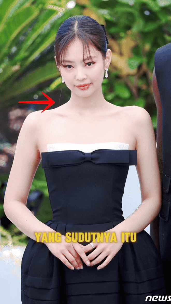 Rộ trào lưu tiêm vai móc áo giống Jennie- Ảnh 5. Rộ trào lưu tiêm vai móc áo giống Jennie- Ảnh 5.