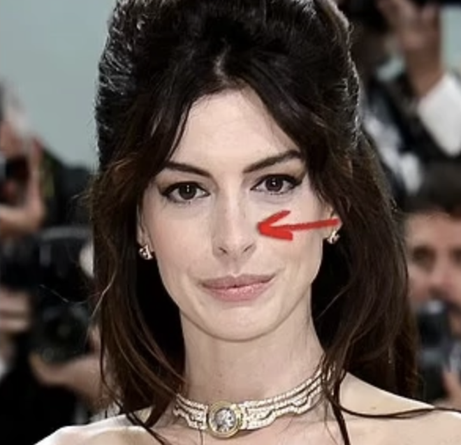 Quảng c&aacute;o sản phẩm chống l&atilde;o ho&aacute; của Anne Hathaway g&acirc;y tranh c&atilde;i- Ảnh 12.