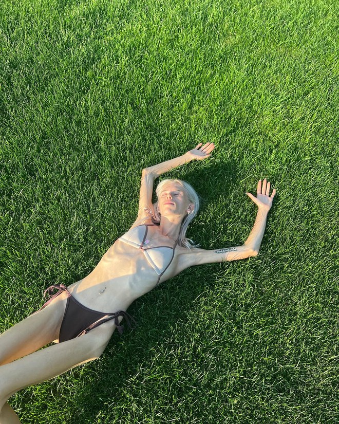 Từ bộ xương khô trở nên tràn đầy sức sống: Hành trình chữa lành của cô gái từng bị cân nặng kiểm soát cả cuộc đời- Ảnh 2. Từ bộ xương khô trở nên tràn đầy sức sống: Hành trình chữa lành của cô gái từng bị cân nặng kiểm soát cả cuộc đời- Ảnh 2.