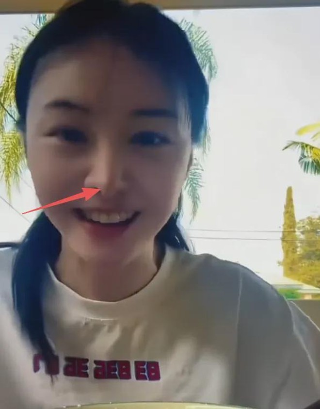 Khó tin nổi đây là Trịnh Sảng sau khi “dao kéo” toàn bộ gương mặt - Ảnh 5.