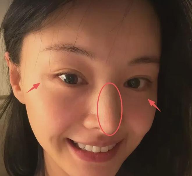 Khó tin nổi đây là Trịnh Sảng sau khi “dao kéo” toàn bộ gương mặt - Ảnh 4.