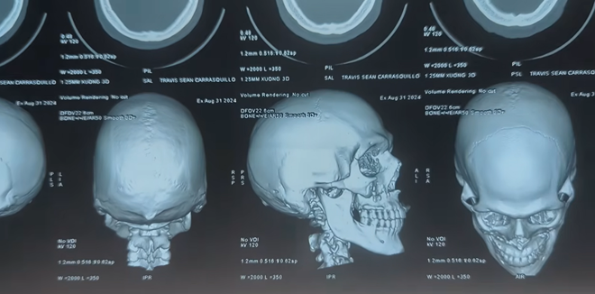 Kh&aacute;ch T&acirc;y phẫu thuật tại 1 bệnh viện ở Đ&agrave; Nẵng: "Nếu l&agrave;m ở Mỹ, t&ocirc;i sẽ phải nợ nần chồng chất trong &iacute;t nhất 10 năm"- Ảnh 3.