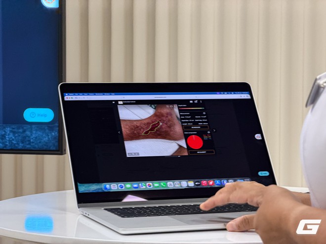 Từ rửa tay đến đồ bảo hộ: Khi iPad trở th&agrave;nh &ldquo;huấn luyện vi&ecirc;n AI&rdquo; trong bệnh viện Singapore - Ảnh 10.