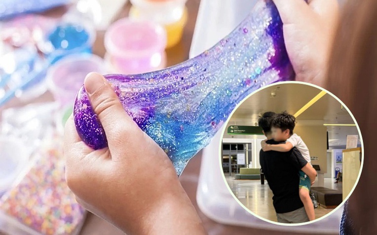 Bé trai 5 tuổi ở Hà Nội phù mạch, sưng mắt, miệng sau 30 phút chơi "chất nhờn ma quái" slime- Ảnh 1.