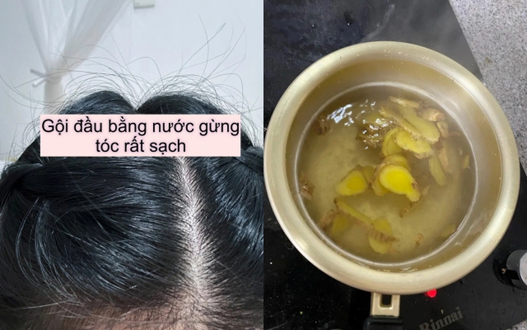 bong da truc tiep xoi lac