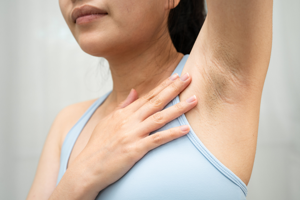 C&aacute;c nguy&ecirc;n nh&acirc;n v&agrave; những c&aacute;ch trị th&acirc;m n&aacute;ch cực hiệu quả- Ảnh 2.