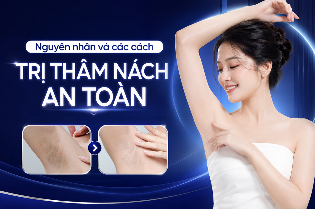 C&aacute;c nguy&ecirc;n nh&acirc;n v&agrave; những c&aacute;ch trị th&acirc;m n&aacute;ch cực hiệu quả- Ảnh 1.