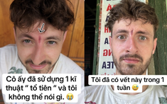 Khách Tây bất ngờ bị "phong ấn" trên trán vì trót than đau đầu khi tới Việt Nam