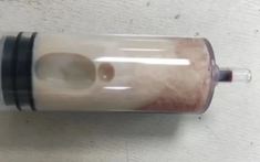 Bức ảnh "cốc trà sữa" gây rùng mình ớn lạnh