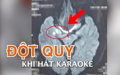 Đang hát karaoke, người đàn ông đột ngột nói khó, tê yếu nửa người